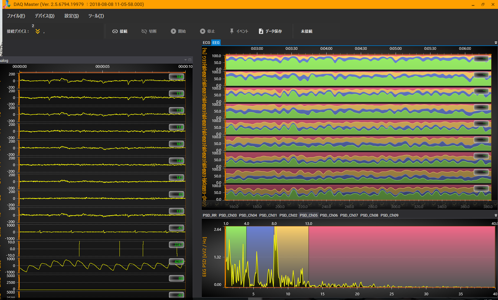 EEG